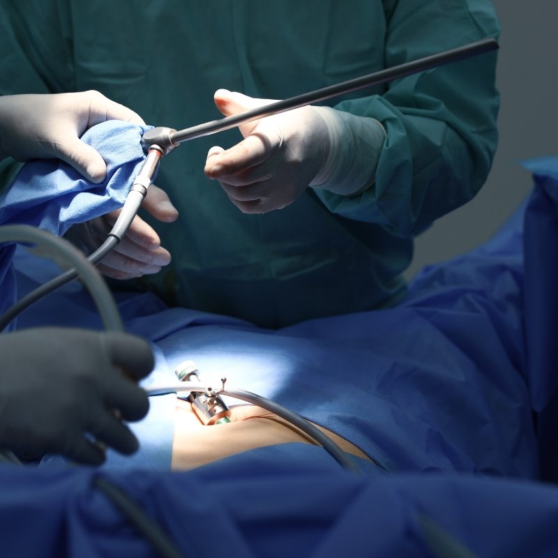 Enfermedades Colorectales Laparoscópica